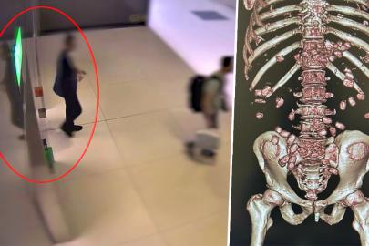 İstanbul Havalimanı'nda yürümekte zorlanan yolcu polisi alarma geçirdi. Gerçek hastanede ortaya çıktı